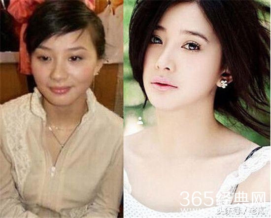 冯小刚拒绝整容脸，半个娱乐圈都被砍了？