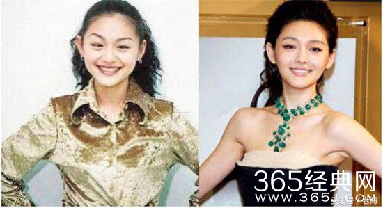 冯小刚拒绝整容脸，半个娱乐圈都被砍了？