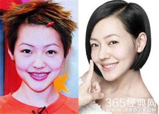 冯小刚拒绝整容脸，半个娱乐圈都被砍了？