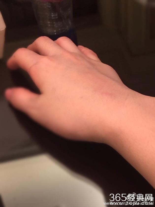 刘亦菲拍戏手受伤 网友：男朋友呢
