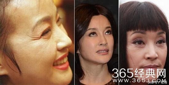 冯小刚拒绝整容脸，半个娱乐圈都被砍了？