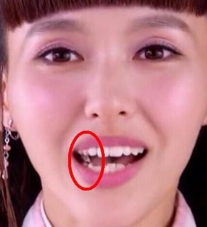 唐嫣拍戏又吃口香糖？粉丝：牙就长那样啊，唐嫣的锅背的真冤！