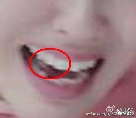 唐嫣嘴里的白色物体原来不是口香糖啊！原谅我不厚道的笑了