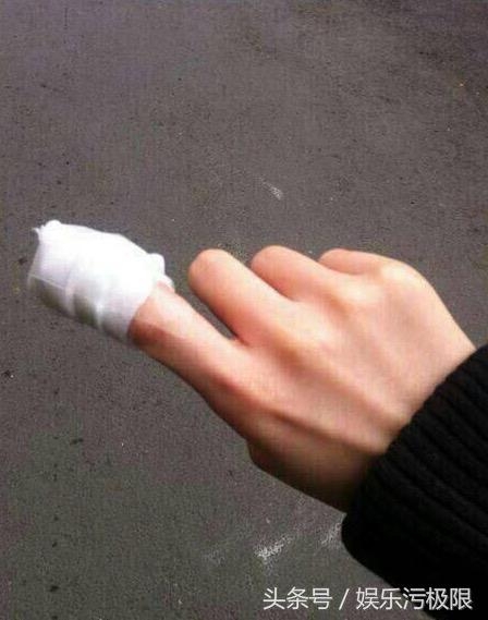 戚薇拍摄影片只是面部受伤这么简单？