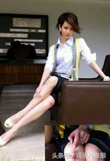 戚薇拍摄影片只是面部受伤这么简单？