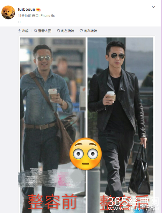 邓超被孙俪曝整容 邓超整容前后对比图