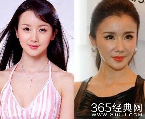 孙菲菲出席活动全程脸僵显疲态 孙菲菲整容前后照对比