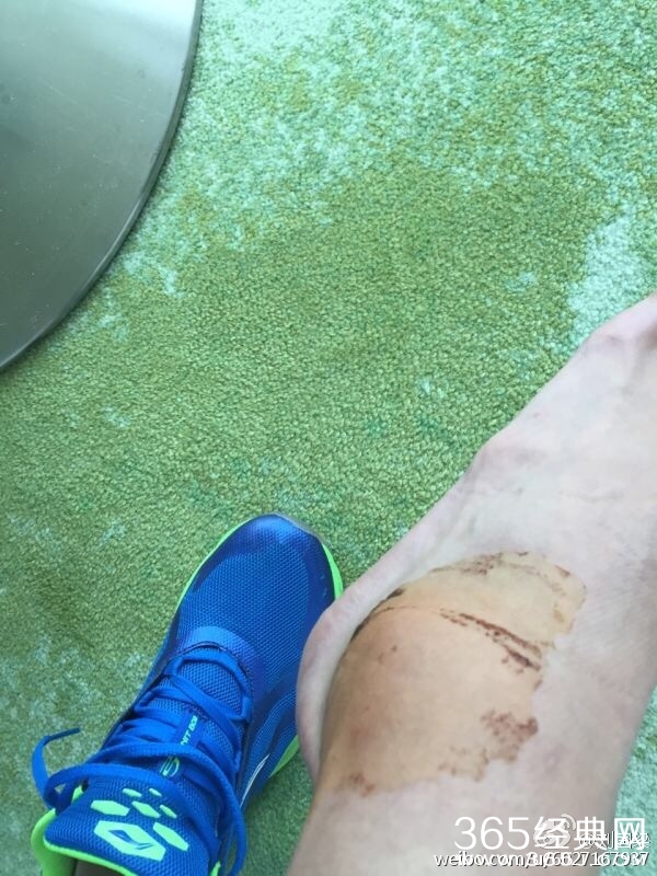 张继科什么时候受的伤 张继科因伤退出乒联总决赛