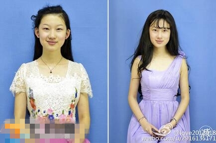 李奕霏整容前后对比照 19岁女孩整容成刘亦菲