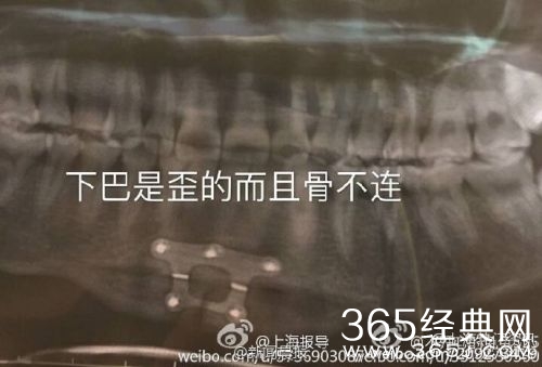 上海九院余东性侵过多少女孩 上海色狼医生于东个人资料