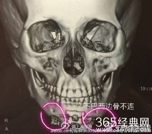 上海九院余东性侵过多少女孩 上海色狼医生于东个人资料