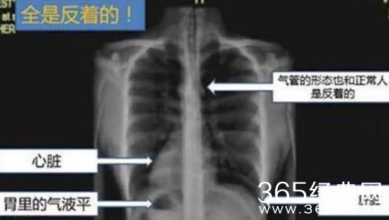 太阳的后裔十大穿帮镜头 太阳的后裔搞笑穿帮镜头曝光（1）