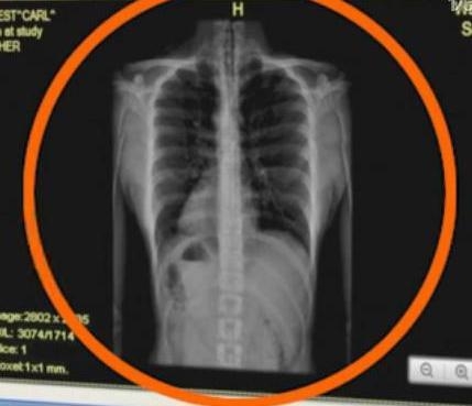 太阳的后裔十大穿帮镜头 太阳的后裔搞笑穿帮镜头曝光（1）