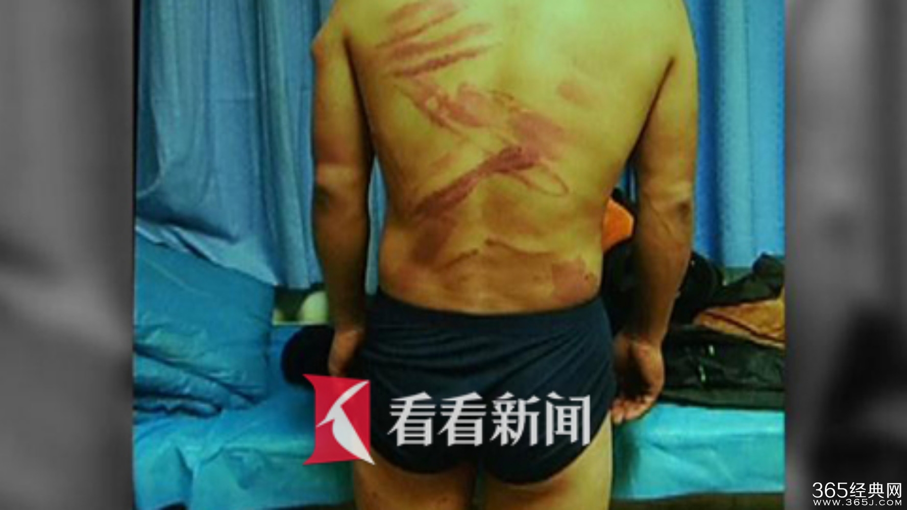 微信交友相亲 却遭被扒光衣服遍体鳞伤丢野外