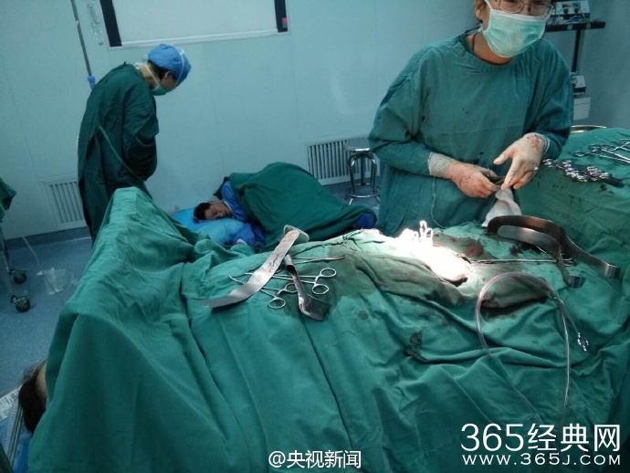 连续40个小时工作 他累倒在手术室