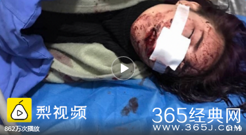 丽江打人事件进展情况如何 打人的被抓了吗