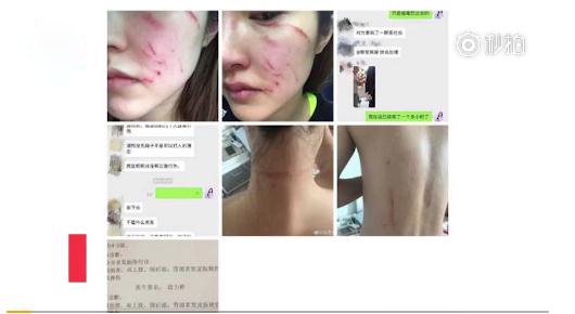 双语主持人丹娜个人资料遭扒 双语主持人丹娜遛狗被暴打现场视频