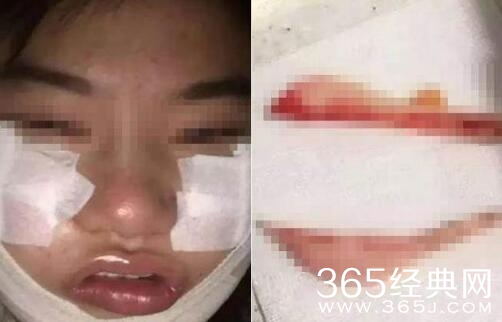 杨幂粉丝花百万整容成杨幂是真的吗 资料照片曝光