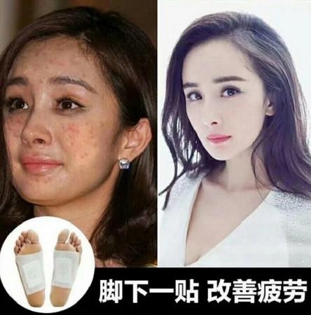 杨幂被P成满脸红斑是怎么回事 杨幂会起诉无良商家吗