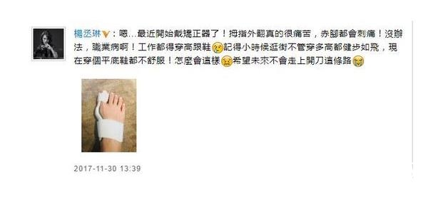 杨丞琳脚趾带矫正器是怎么回事 杨丞琳的脚趾怎么了