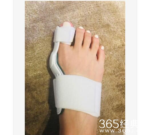 杨丞琳脚趾带矫正器是怎么回事 杨丞琳的脚趾怎么了