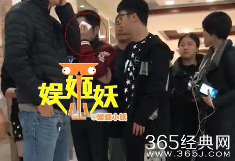 邹市明眼睛受伤被紧急送医院 邹市明眼睛为什么受伤