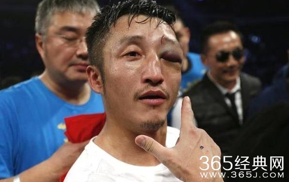 邹市明眼疾初步确诊报告出炉 邹市明眼睛现在究竟是什么状况