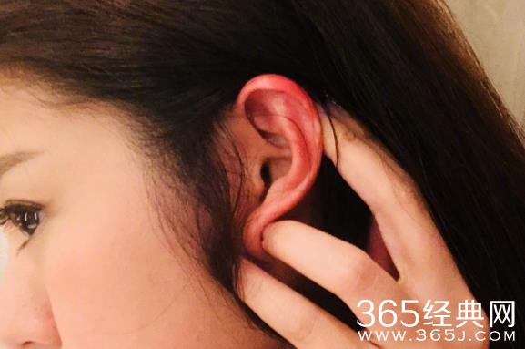 安以轩耳朵被烫伤是什么情况 安以轩耳朵被烫伤严重吗