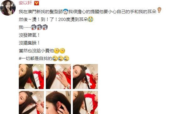 安以轩耳朵被烫伤是什么情况 安以轩耳朵被烫伤严重吗