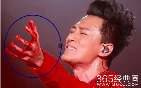 林峰被曝演唱会意外受伤满手鲜血 林峰演唱会意外受伤严重吗
