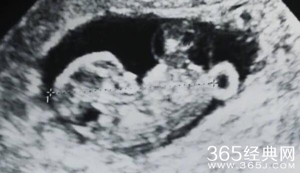 严屹宽老婆杜若溪被曝怀孕 严屹宽老婆怀孕几个月了