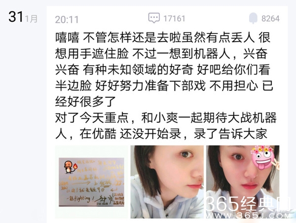 郑爽眼睛怎么受伤的 郑爽眼睛为什么贴着纱布