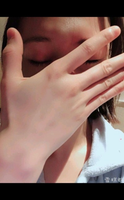 这就是铁甲发布会郑爽右眼贴着纱布是怎么回事 郑爽右眼怎么了