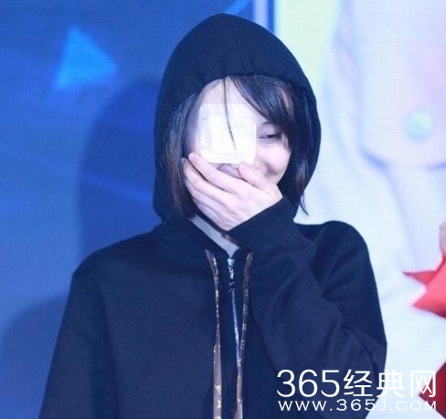 郑爽眼睛怎么受伤的 郑爽眼睛为什么贴着纱布