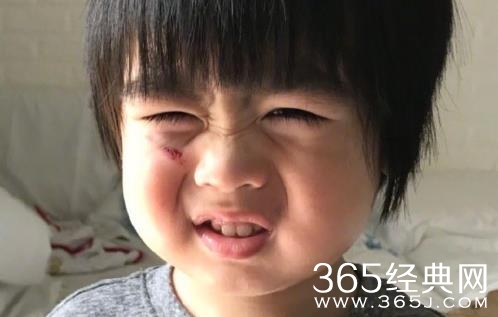 林志颖晒小儿子受伤照 林志颖小儿子为什么受伤 严重吗