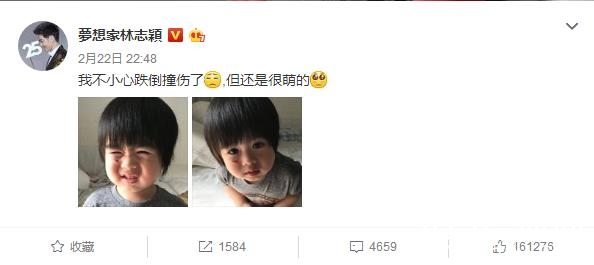 林志颖晒小儿子受伤照 林志颖小儿子为什么受伤 严重吗