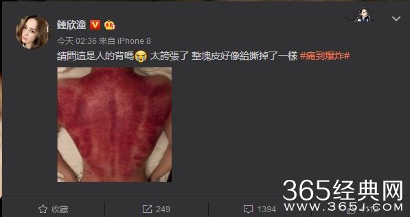 阿娇深夜晒血淋淋后背照 后背像被撕掉一层皮是怎么回事