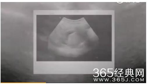 孙燕姿晒二胎B超视频，还配上了音乐