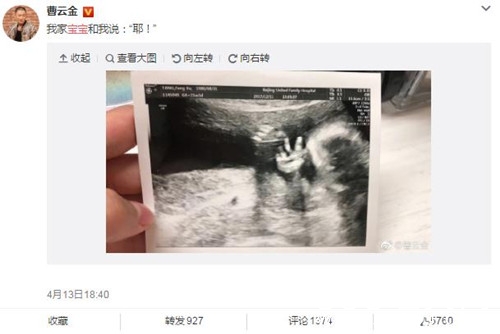 曹云金晒宝宝B超照，小手手势亮了