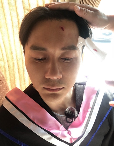奔跑吧2太原录制现突发状况 李晨被学士帽砸伤