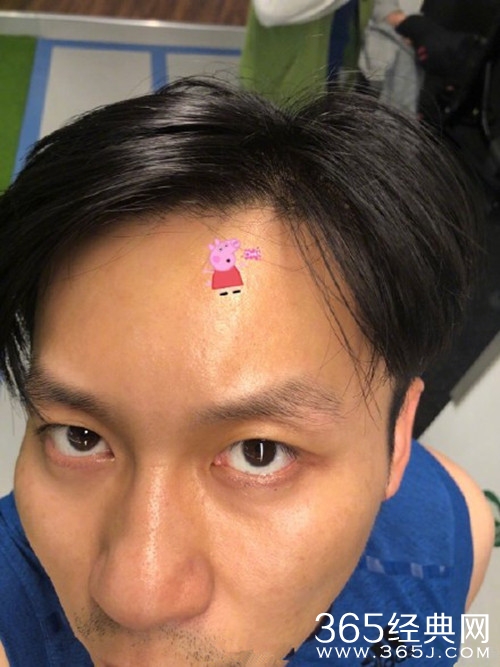 李晨额头伤口贴小猪佩奇，反遭范冰冰吐槽