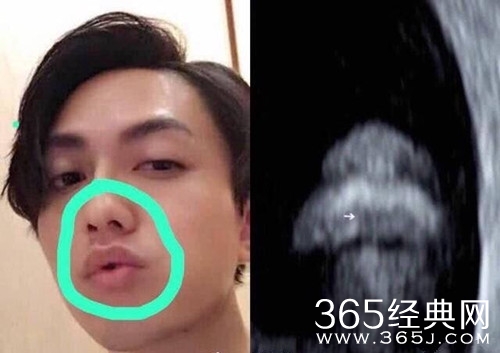 丁文琪罕见曝光7月孕照，卸货进入倒计时