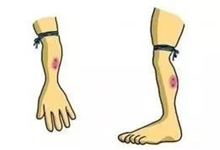 【就是个水槽】第六十八期：被毒蛇咬伤之后怎么办？相信电视剧你就凉了，不如先发个朋友圈。