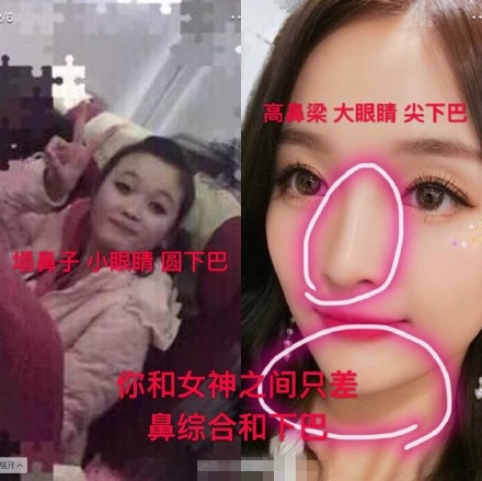 创造101吴宣仪被曝整容前后对比照遭质疑 她真整容了吗