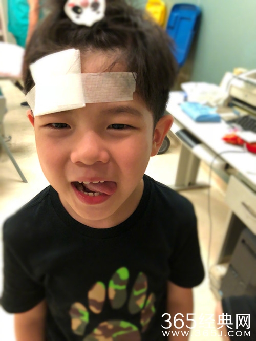 胡可晒安吉受伤照，包着纱布的安吉仍面带笑容