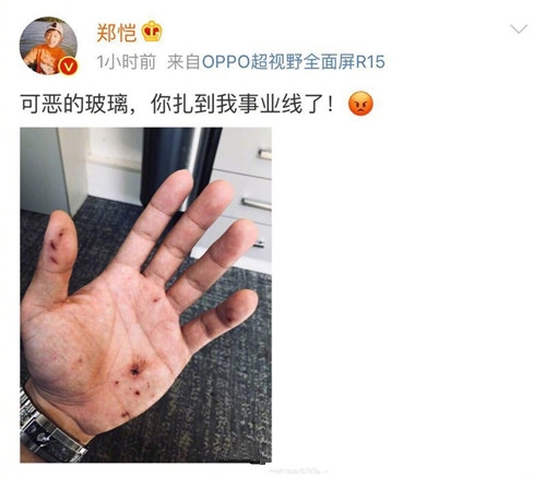 郑恺拍戏意外受伤 其第一反应被赞敬业