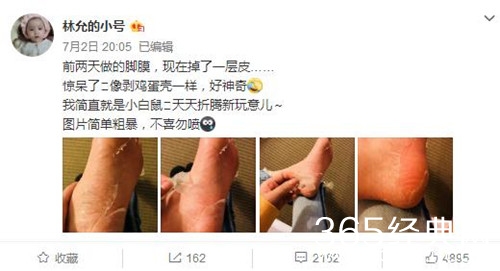 林允回应公开撕脚皮 多名网友被其耿直路转粉