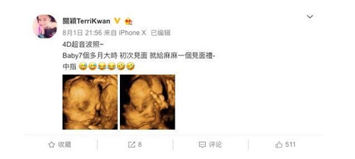 关颖晒三胎宝宝B超照 言语里充满喜悦之情