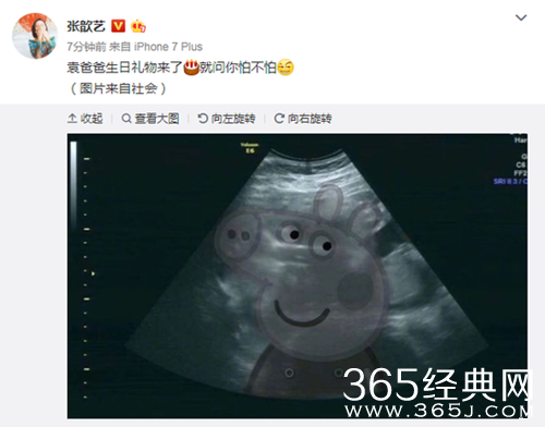 张歆艺晒宝宝B超照宣布怀孕 袁弘最好的生日礼物