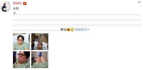 高晓松晒拔智齿照 遭丁香医生调侃：拔牙不会让脸变小